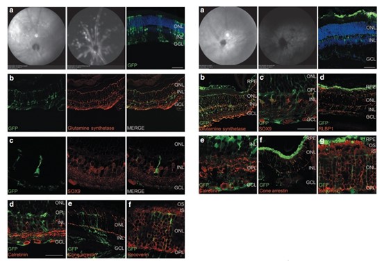 AAV2/shH10Y-RLBP1-GFP感染小鼠视网膜结果图（红色为穆勒细胞marker）