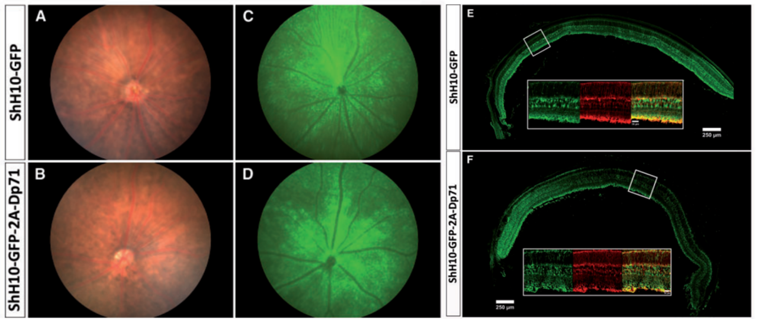 AAV-shH10感染视网膜结果图