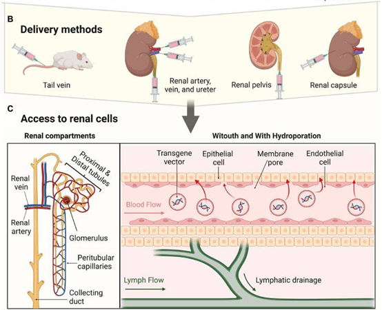 肾脏的局部载体递送方式