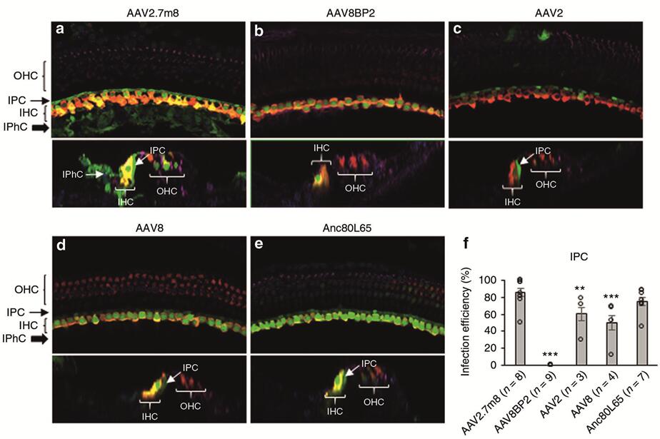 不同血清型AAV感染新生小鼠耳蜗内柱细胞和内指骨细胞