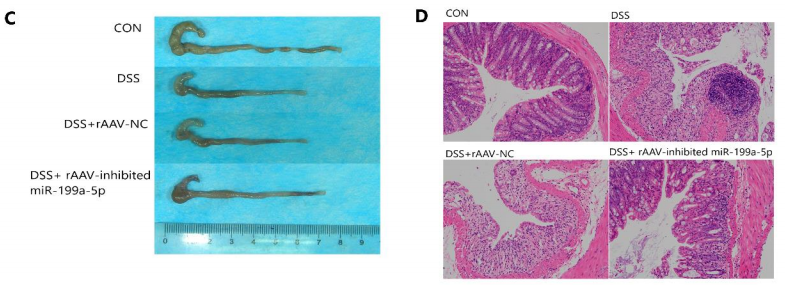 抑制miR-199a-5p减轻DSS诱导的溃疡性结肠炎