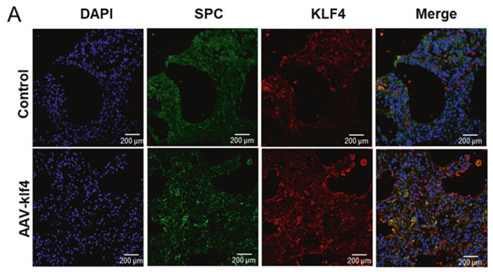 KLF4在注射AAV-6的小鼠中的过表达