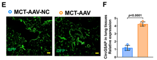 AAV2/6在肺组织中调控circGSAP的高表达