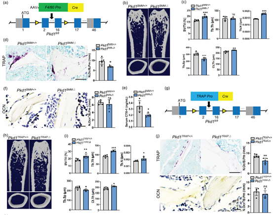 破骨细胞谱系中Pkd1缺失的小鼠表现出骨量增加和骨吸收减少