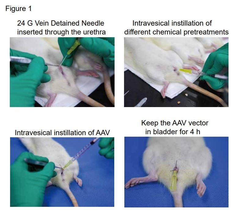 AAV膀胱灌注流程示意图