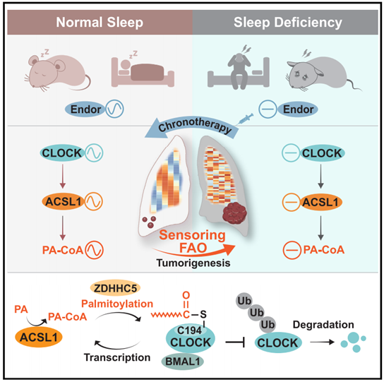 睡眠不足促癌新机制