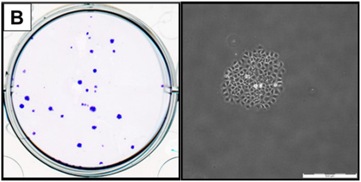 细胞克隆形成图