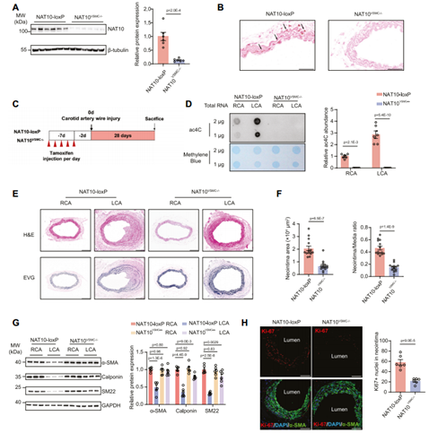 VSMC特异性NAT10基因敲除减弱导丝损伤诱导的新生内膜形成和VSMC表型转换