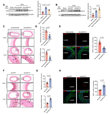 NAT10在大鼠颈动脉球囊损伤诱导的VSMC表型转换和新内膜形成中是必要且充分的