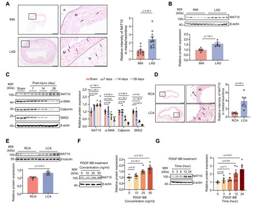 NAT10在血管重构过程中表达增加