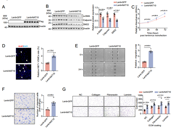 NAT10过表达诱导体外VSMC表型转换